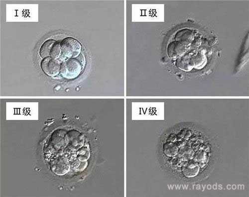 瑞丽市代妈就到ymfc_试管胚胎等级分类，二级胚胎是不是优质胚胎？