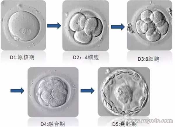 瑞丽市代妈就到ymfc_试管胚胎等级分类，二级胚胎是不是优质胚胎？