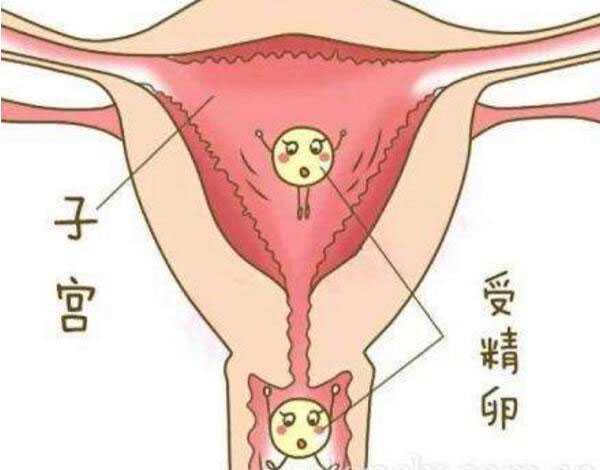会泽县有人想做代妈吗_泰国试管婴儿可以科学避免生化妊娠吗?