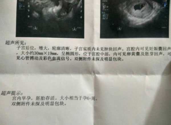 巴塘县49岁借卵生子需要住院吗_巴塘县41岁供卵试管_试管婴儿移植成功好孕诞下